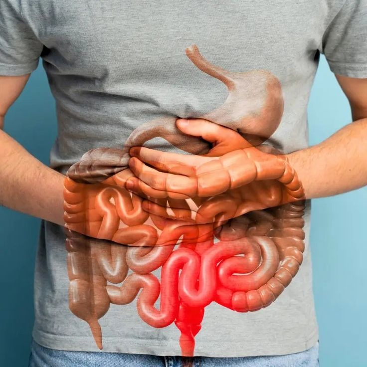 DailyWellness™ Gut Support Capsule