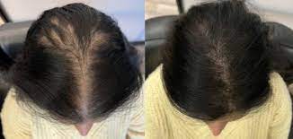 DailyWellness™ Hair Growth Accelerator Soft Chews